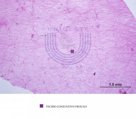 tipos de tecido conjuntivo frouxo
