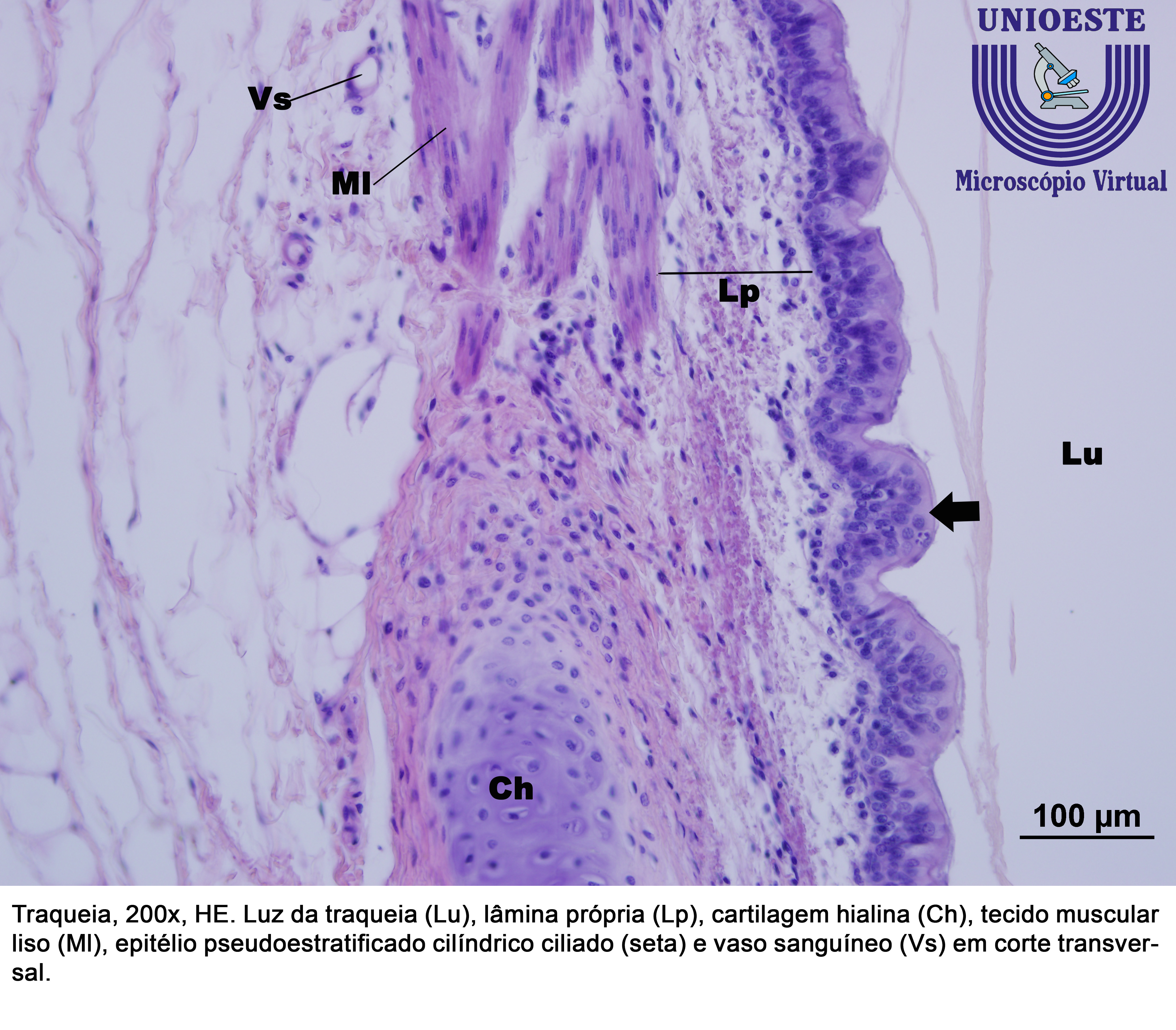 Traquéia cartilagem hialina40xcortado e legendado – Histologia Interativa